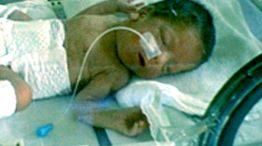 La beba continúa en estado crítico pero sus padres no pierden las esperanzas.