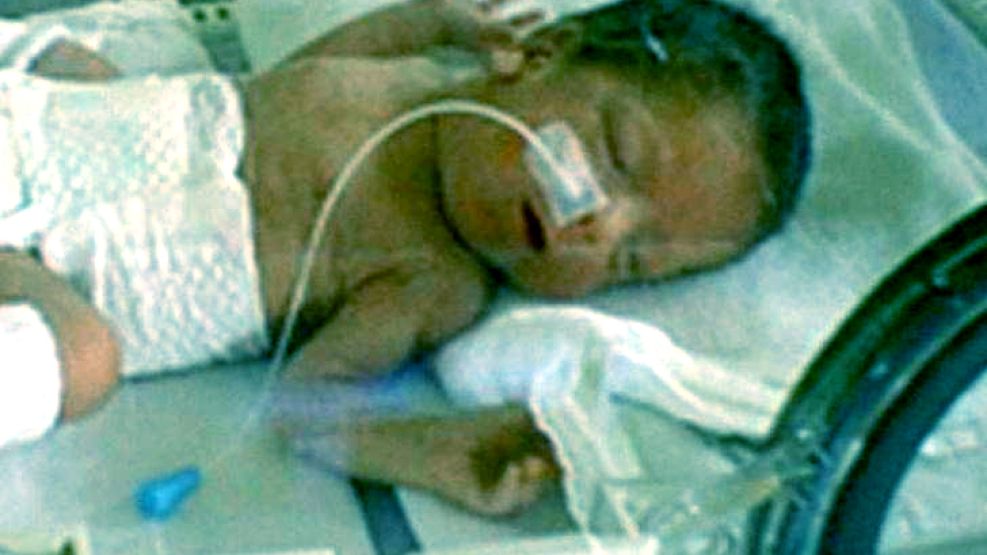 La beba continúa en estado crítico pero sus padres no pierden las esperanzas.