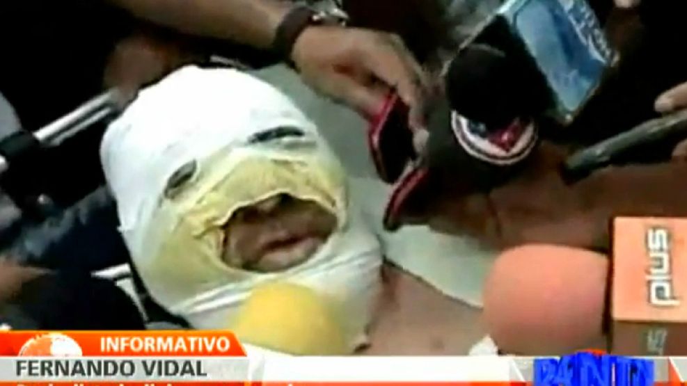 Las primeras declaraciones del periodista atacado mientras salía al aire.