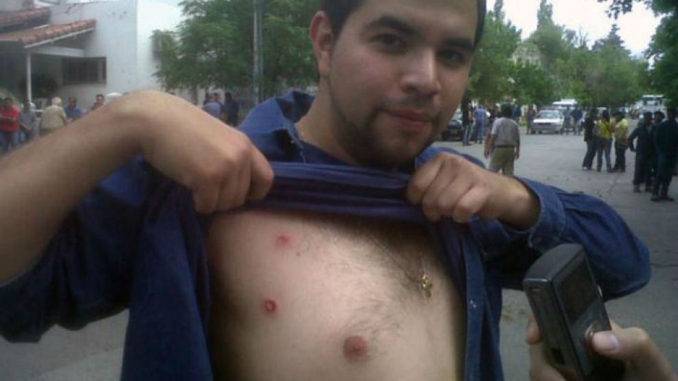 Un trabajador recibió proyectiles durante la manifestación.