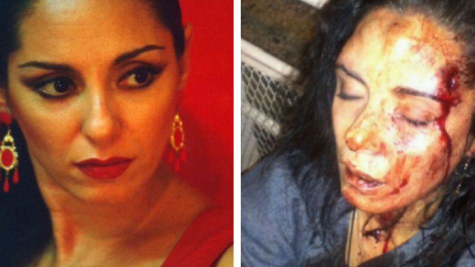 La bailaora de flamenco, Alicia Fiuri, fue brutalmente atacada por su expareja. "Entro a matarla", le contó su madre a Perfil.com.
