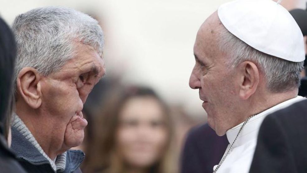 Después de bendecir a Vinicio Rivas, el Papa abrazó a un hombre con el rostro desfigurado.