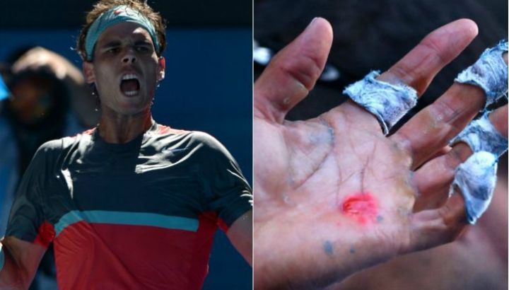 nadal