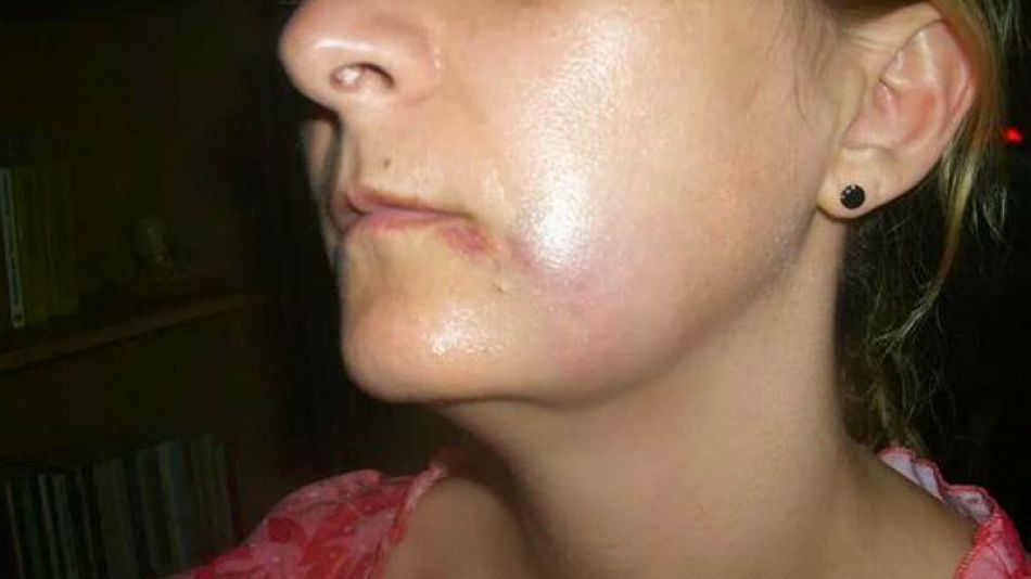 Foto publicada por Laura Elías en la que exhibe golpes en su rostro.