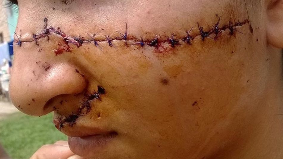 La joven de 15 años fue atacada el viernes a la noche en la ciudad de Juan Domingo Perón, Formosa.