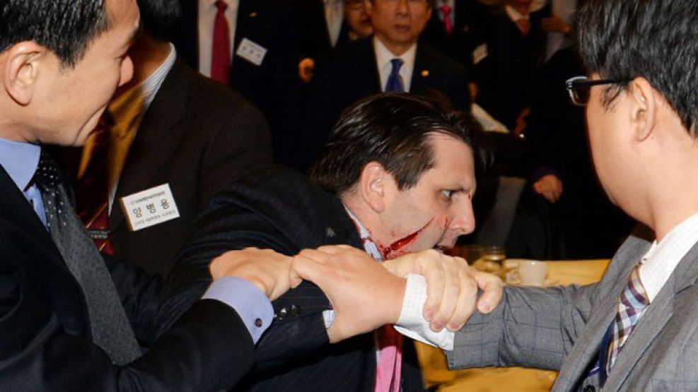 Mark Lippert, luego de ser atacado