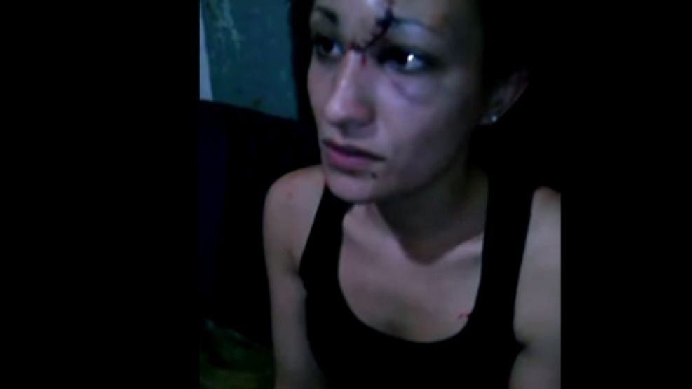 Victima. Analía Maldonado se atrevió a mostrar su rostro desfigurado por los golpes de su ex.