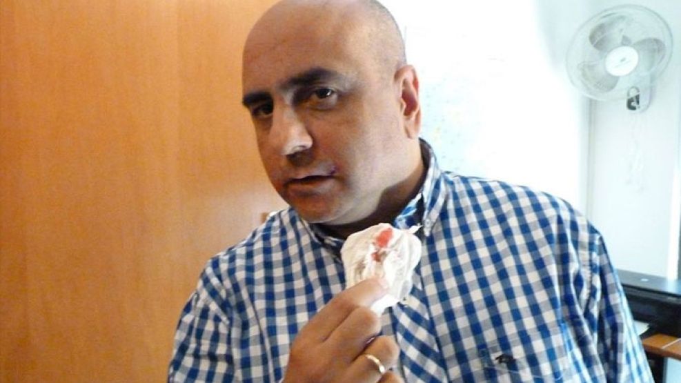 Mario Casalongue fue agredido el jueves pasado por el diputado nacional Francisco De Narváez.