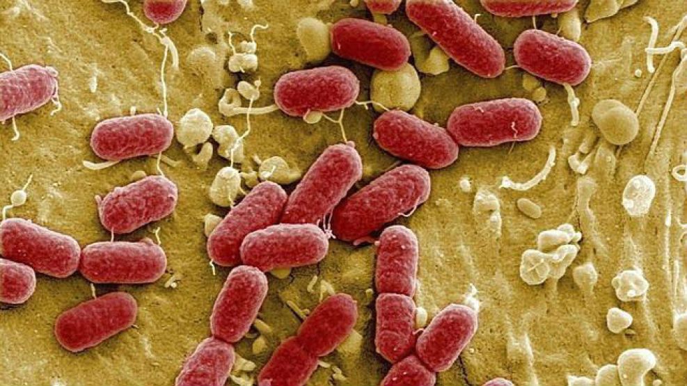 el virus Esterichia coli, uno de los mas comunes en la carne