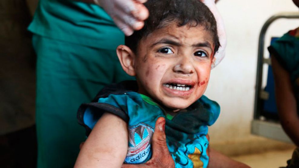 Un niño sirio recibe tratamiento en un hospital improvisado tras un ataque aéreo contra un mercado de verduras en Maaret al- Numan , en el norte de la provincia de Idlib de Siria, el 19 de abril de 20