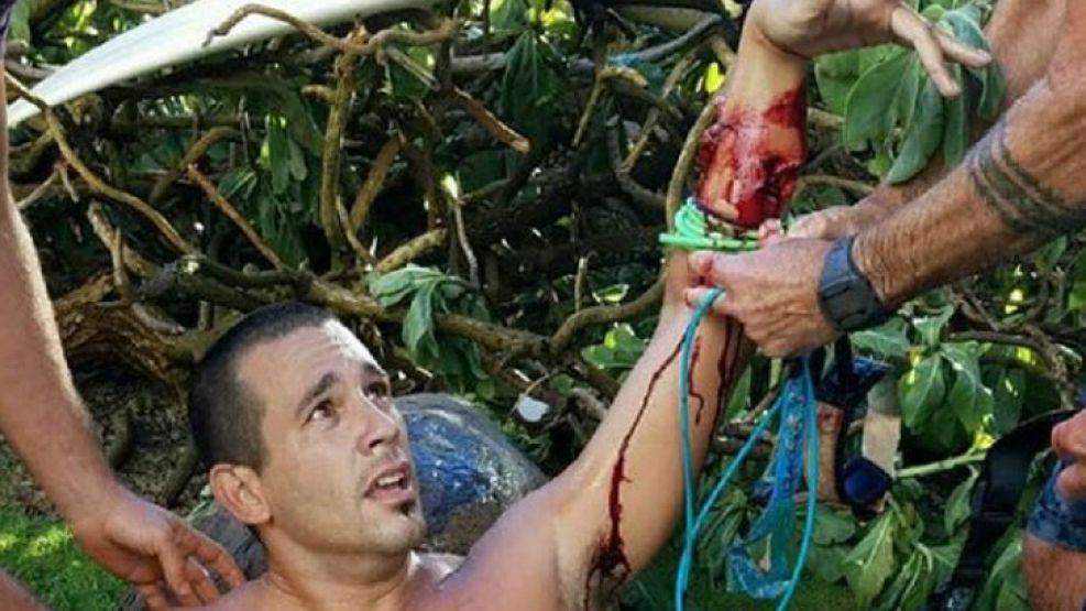 Federico Jaime, el surfer argentino atacado por un tiburón.