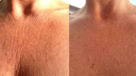 1129_envejecimiento_g