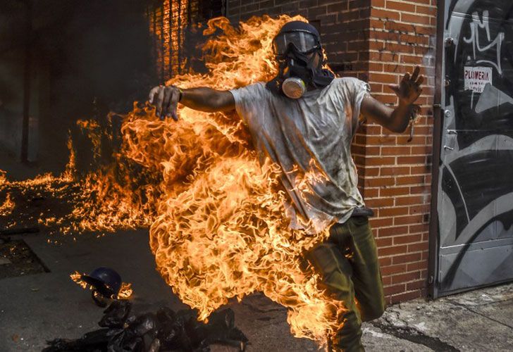 Hombre prendido fuego en Venezuela