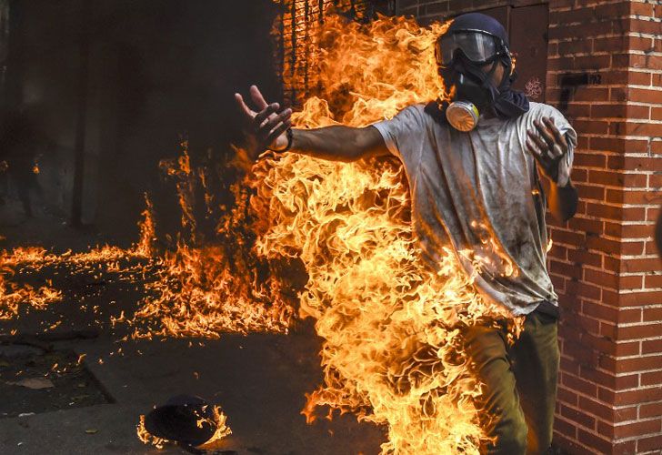 Hombre prendido fuego en Venezuela