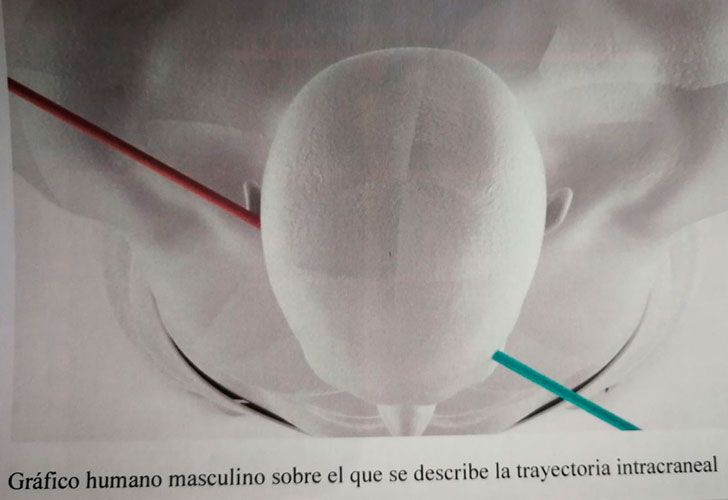 Recreaciones. A través de maquetas virtuales los peritos de las partes ensayaron distintas hipótesis de cómo murió el fiscal. La primera, implicaría la presencia de un solo agresor.