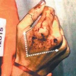 The hand of Alberto Nisman, photographed at the crime scene, during the initial moments of the invesgitation into his death.