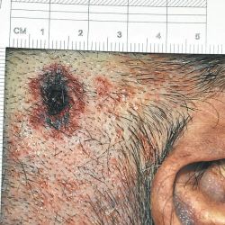 A photograph of the gunshot wound that killed late AMIA special prosecutor Alberto Nisman.