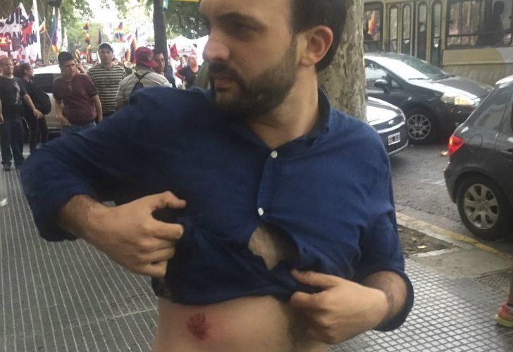 Leonardo Grosso mostró su torso herido y denunció que fue una mordida de un perro de la Gendarmería.