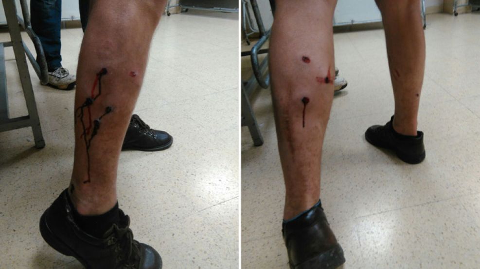 Las heridas que recibió Marcelo Silvestro