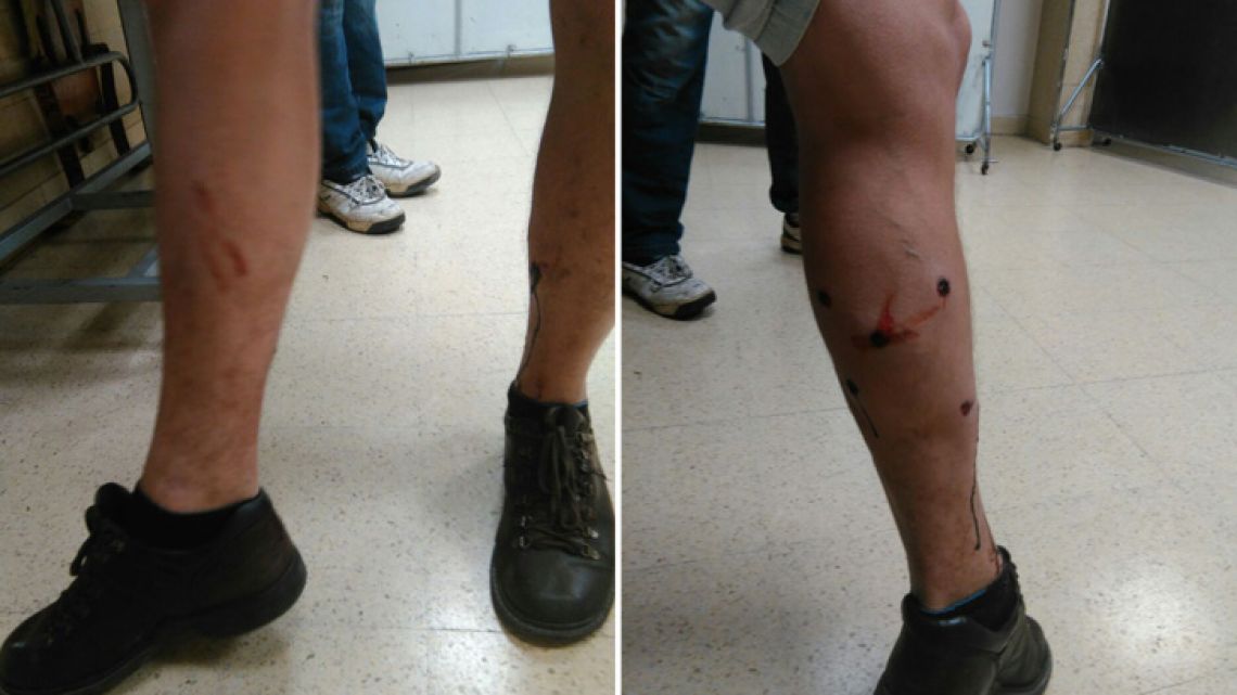 Perfil photo journalist Marcelo Silvestro was shot with rubber bullets during yesterday's protest outside Congress.