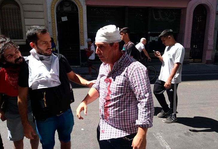 Mauro Fulco, periodista de C5N herido por manifestantes.