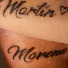morena-rial-tatuaje-borrado3