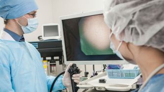 estudio endoscopia 02102018