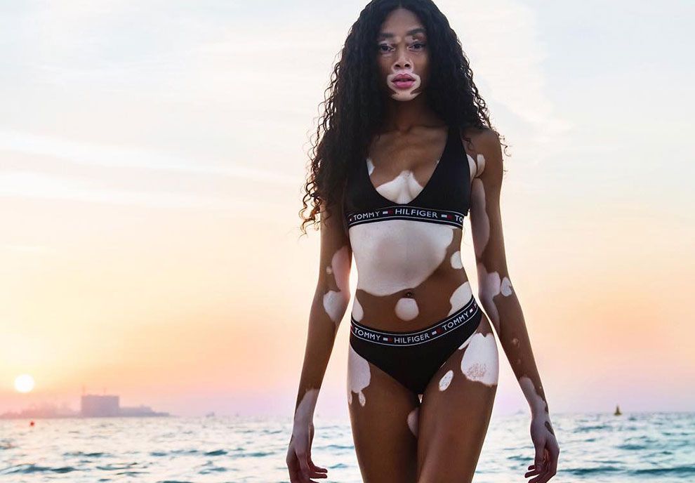 Winnie Harlow y su descargo contra la prensa: 