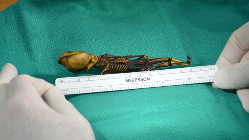 Ata, el pequeño cadáver hallado en Chile.