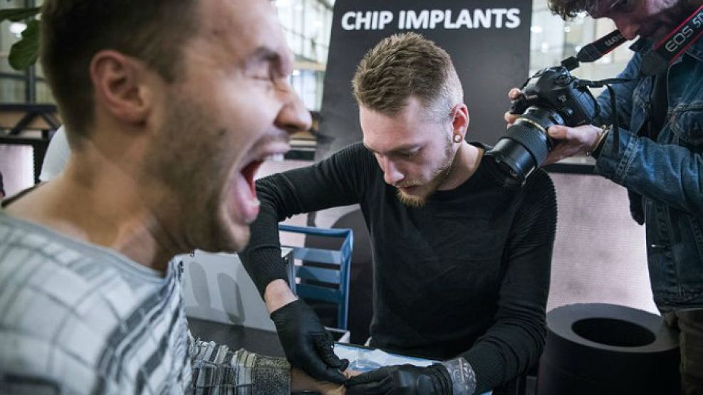 La tecnología a veces duele: un hombre se implanta un chip en Suecia.