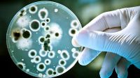Bacteria estreptococo, la causante de las muertes.