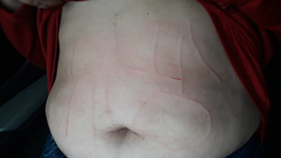 La docente fue forzada a entrar en un auto donde le escribieron la frase ollas no en el abdomen utilizando un punzón.