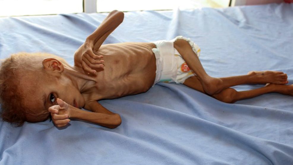Los pobres chicos yemenitas pagan el salvajismo y la ignorancia de los mayores.