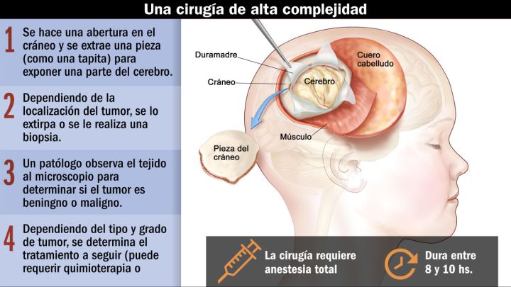 En Argentina se diagnostican 1.400 nuevos canceres por año en menores de 15 años.
