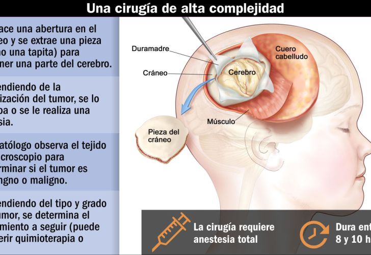 Tumor cerebral benigno tratamiento