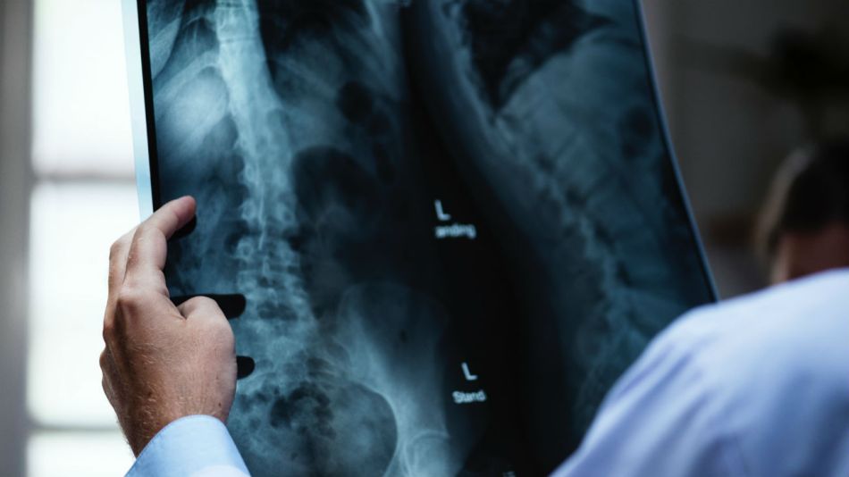 implant files dispositvos medicos 20181125