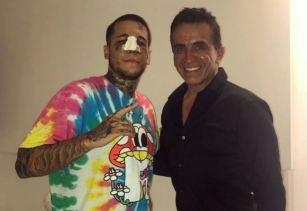 1216_Alex_Caniggia_Nariz