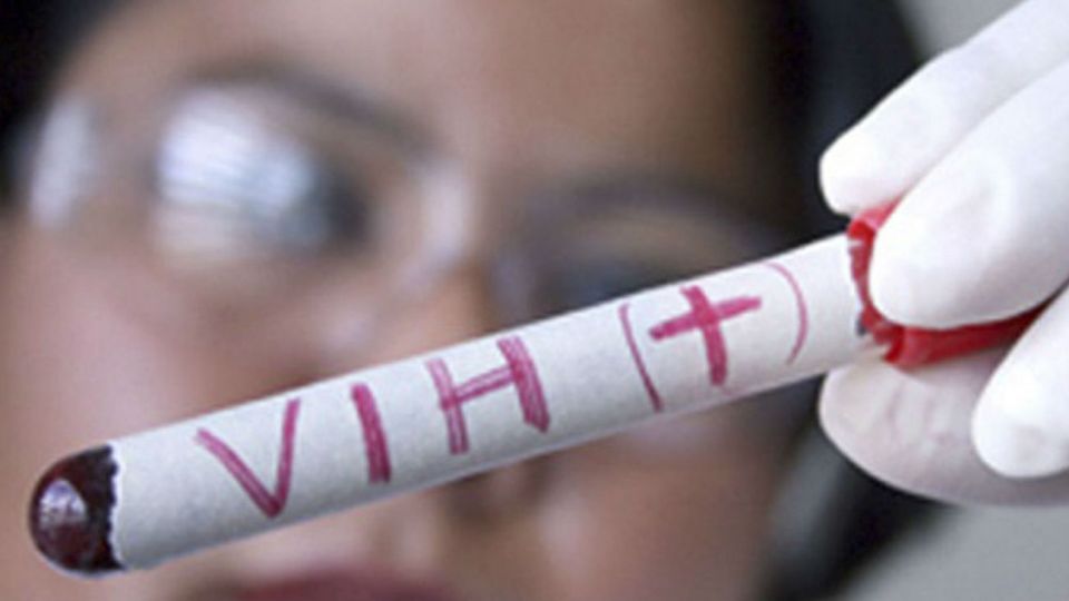 El sida es como se denomina a los estadios más avanzados de la infección por VIH.