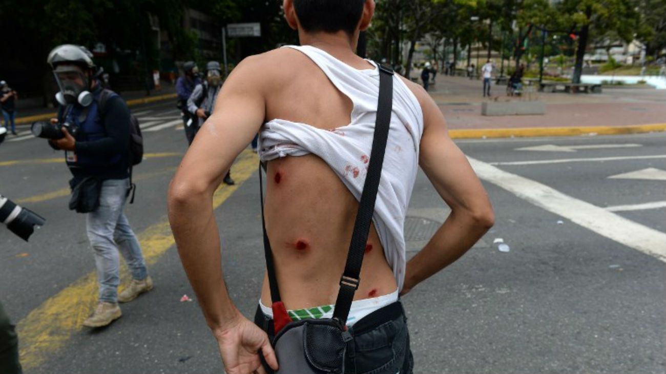 La represión de la policía venezolana contra los manifestantes.