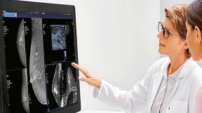 20190202_cancer_shutterstock_g.jpg