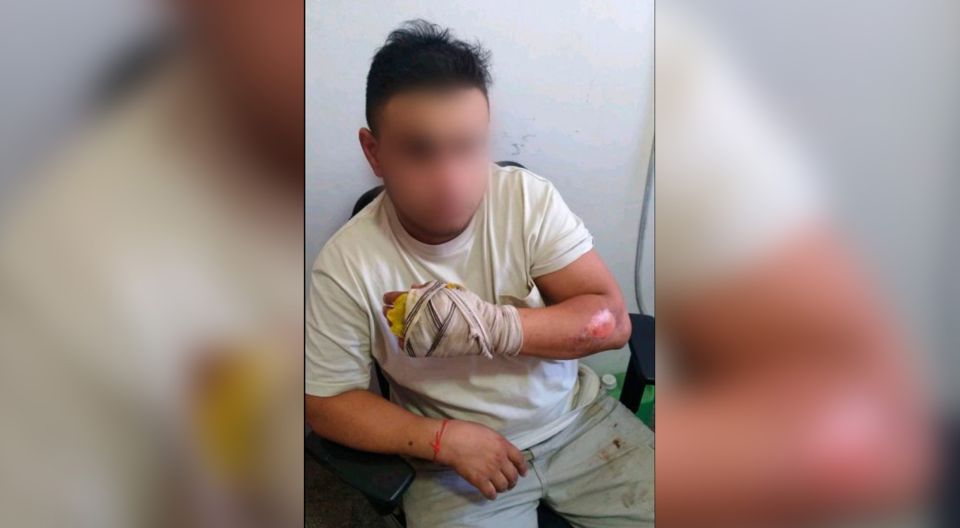 Su novio la prendió fuego y ella se tiró en una pileta para salvarse