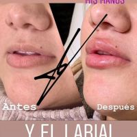Morena Rial labios