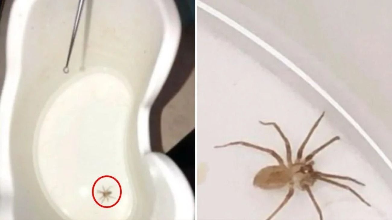 Esta es la araña que sacaron del interior de la oreja de la mujer en Estados Unidos. 