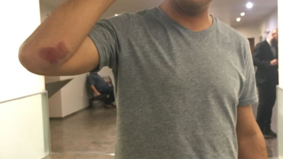 JOSE LUIS CABELLO. El miércoles por la noche lo atacaron mientras circulaba en moto. Ahora se mueve con custodia.