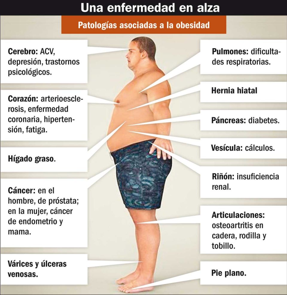 ciencia obesidad
