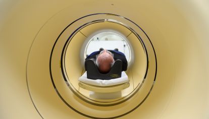 Lilly, AstraZeneca End Trials as Alzheimer Drug Shows No Promise