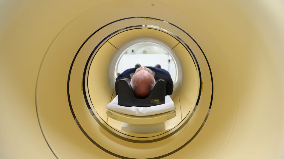 Lilly, AstraZeneca End Trials as Alzheimer Drug Shows No Promise