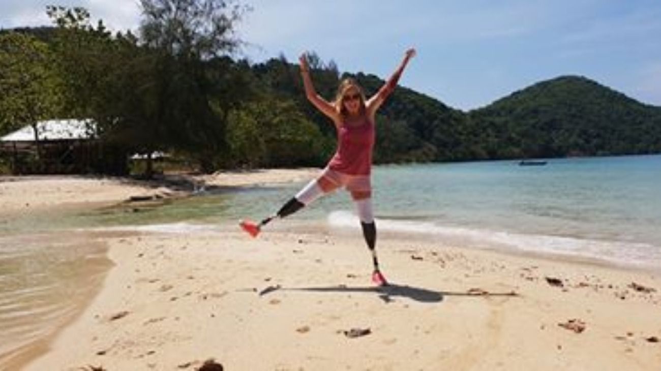 Jayne Carpenter tiene 51 años y acudió al hospital por una fuerte tos que le causaba molestia. Al estudiar en profundidad su situación, los médicos detectaron que padecía sepsis y debieron amputarle las extremidades. 