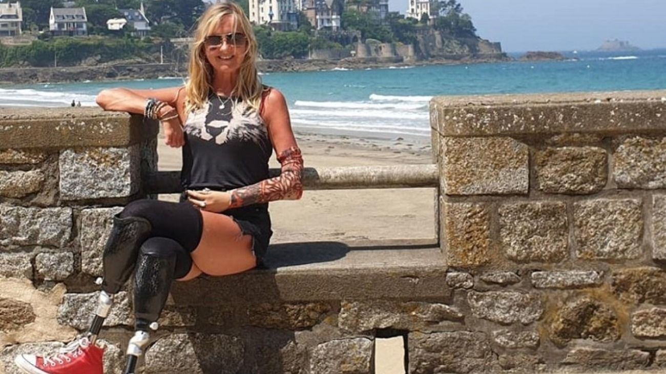 Jayne Carpenter tiene 51 años y acudió al hospital por una fuerte tos que le causaba molestia. Al estudiar en profundidad su situación, los médicos detectaron que padecía sepsis y debieron amputarle las extremidades. 