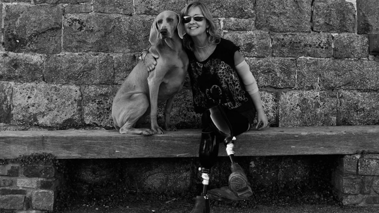 Jayne Carpenter tiene 51 años y acudió al hospital por una fuerte tos que le causaba molestia. Al estudiar en profundidad su situación, los médicos detectaron que padecía sepsis y debieron amputarle las extremidades. 